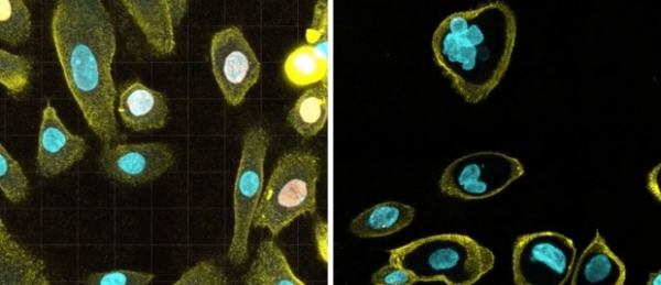 일반세포(좌)와 달리 노화 세포는 세포핵이 두 개 이상인 경우가 더 많은 것으로 나타났다. (사진=서던캘리포니아대(USC) 비터비공과대 제공)