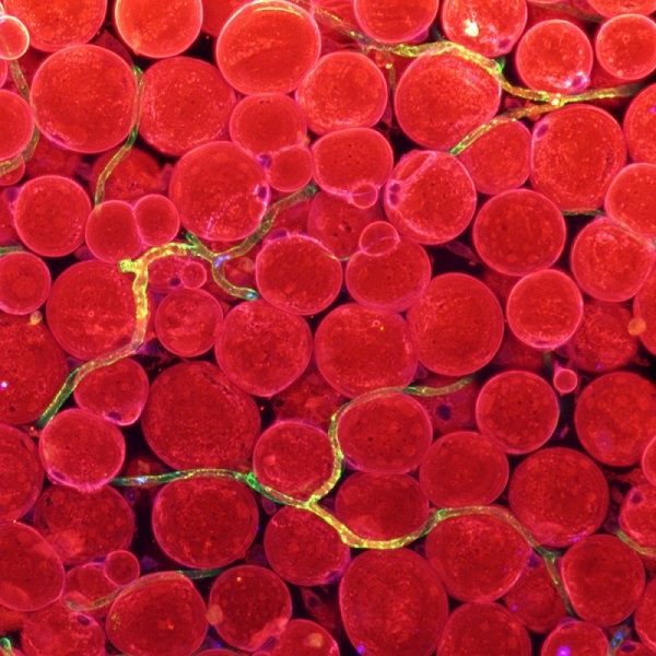 피하지방 혈관(초록색)에서 발현되는 지방산전달인자(파란색)의 이미지. 혈관에 존재하는 지방산전달인자들(초록색과 파란색이 겹쳐 노란색으로 보인다)이 혈중 지방을 지방세포(빨간색)로 전달한다는 것을 유추할 수 있다. (이미지=기초과학연구원)