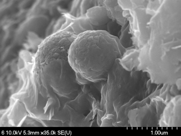 방사성요오드를 흡수하여 변신 중인 공작석의 전자현미경 이미지. (한국원자력연구원)